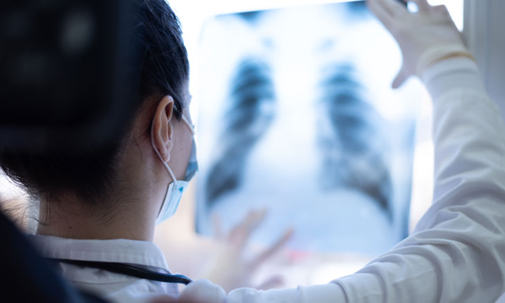 Physician reading X-ray of lungs