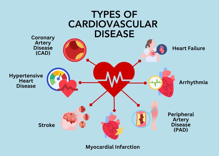 Chart showing cardiovascular disease types